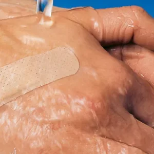 Paul Hartmann-DermaPlastWATER-RESISTANT-Wundpflaster